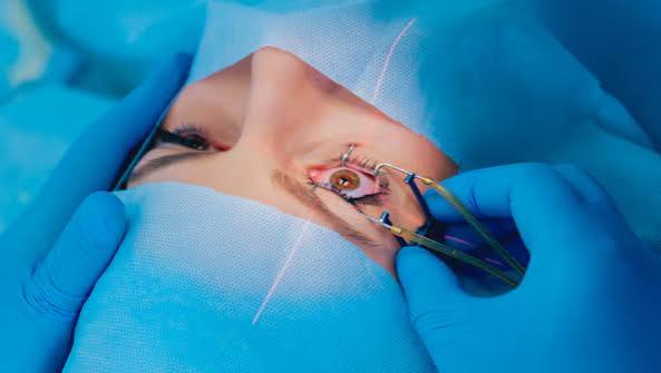 Pterygium Surgery